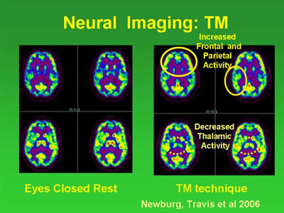 neural imaging